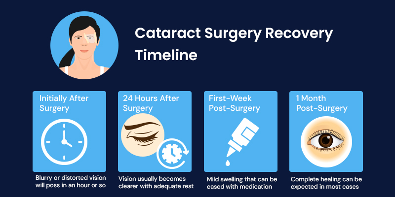 Cataract surgery recovery timeline showing vision improvement stages after surgery