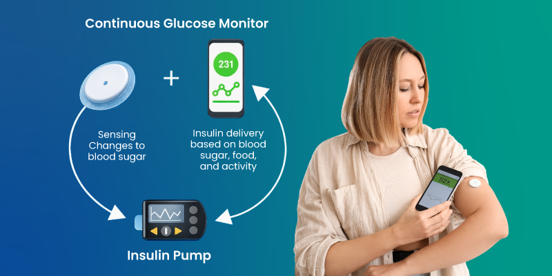 how insulin pump and cgm work together in diabetes management