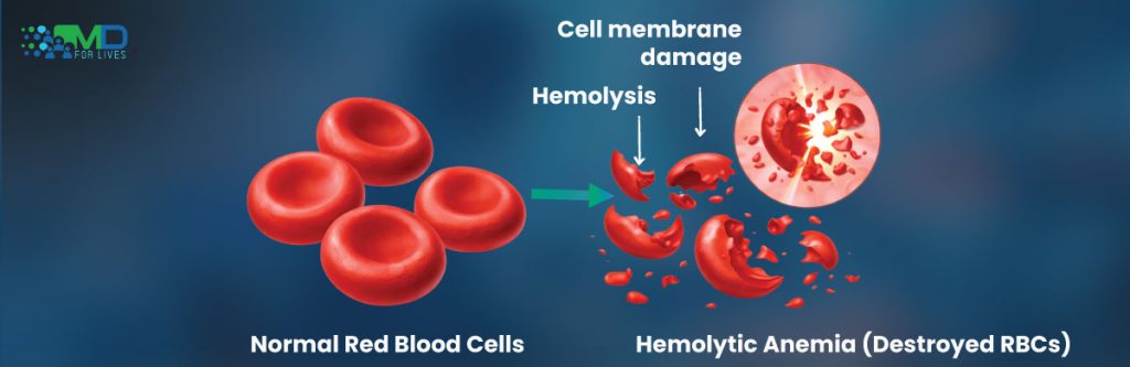 hemolytic anemia